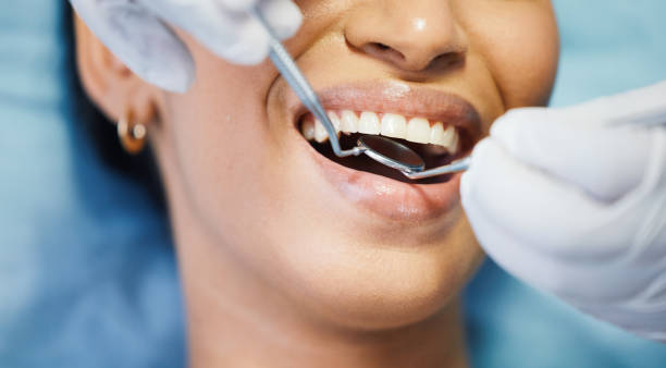 Best Emergency Treatment for Oral Infections in St George, KS