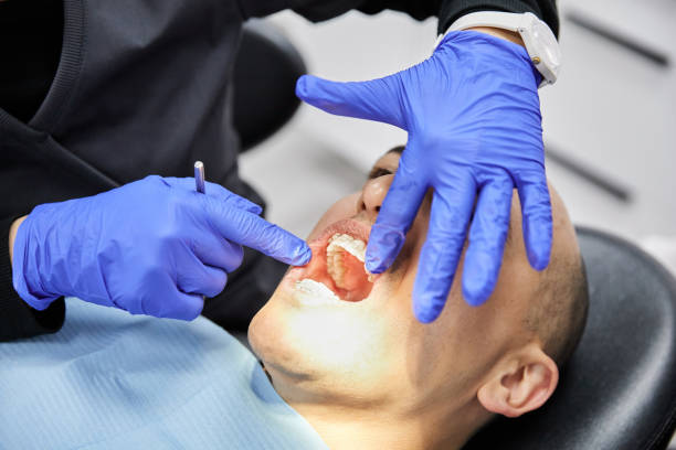 Best Emergency Care for Gum Disease in St George, KS