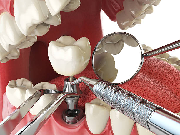 Best Emergency Orthodontic Repairs in St George, KS
